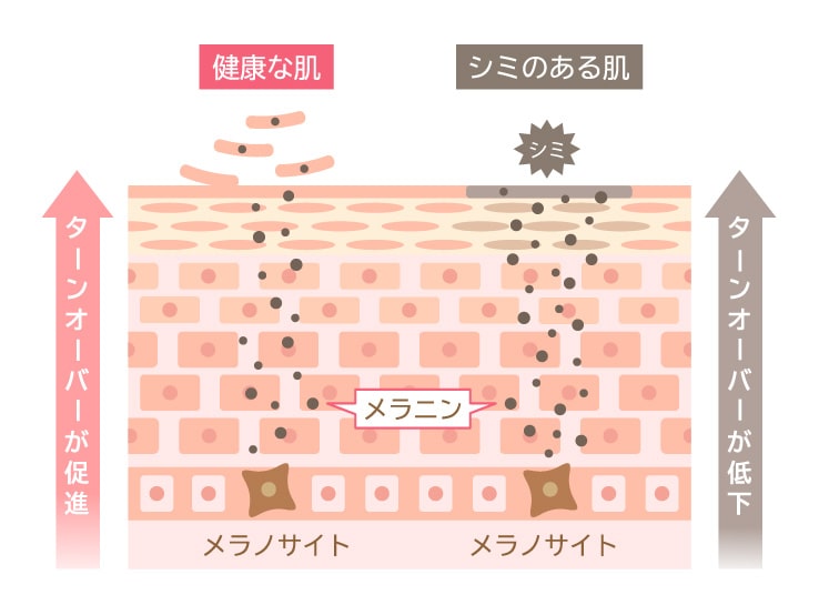 ピーリングのイメージ画像